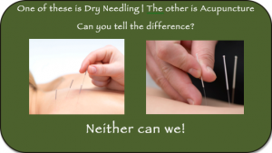 Dry Needle Acu