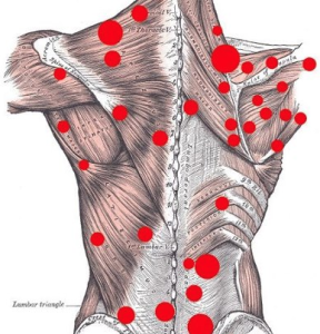 Trigger-point-diagram