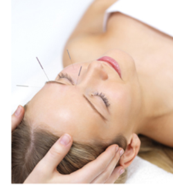 Acupuncture therapy - alternative medicine